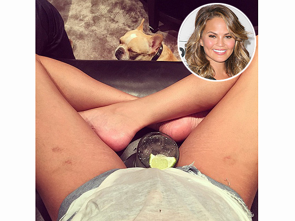 Chrissy Teigen stretch marks